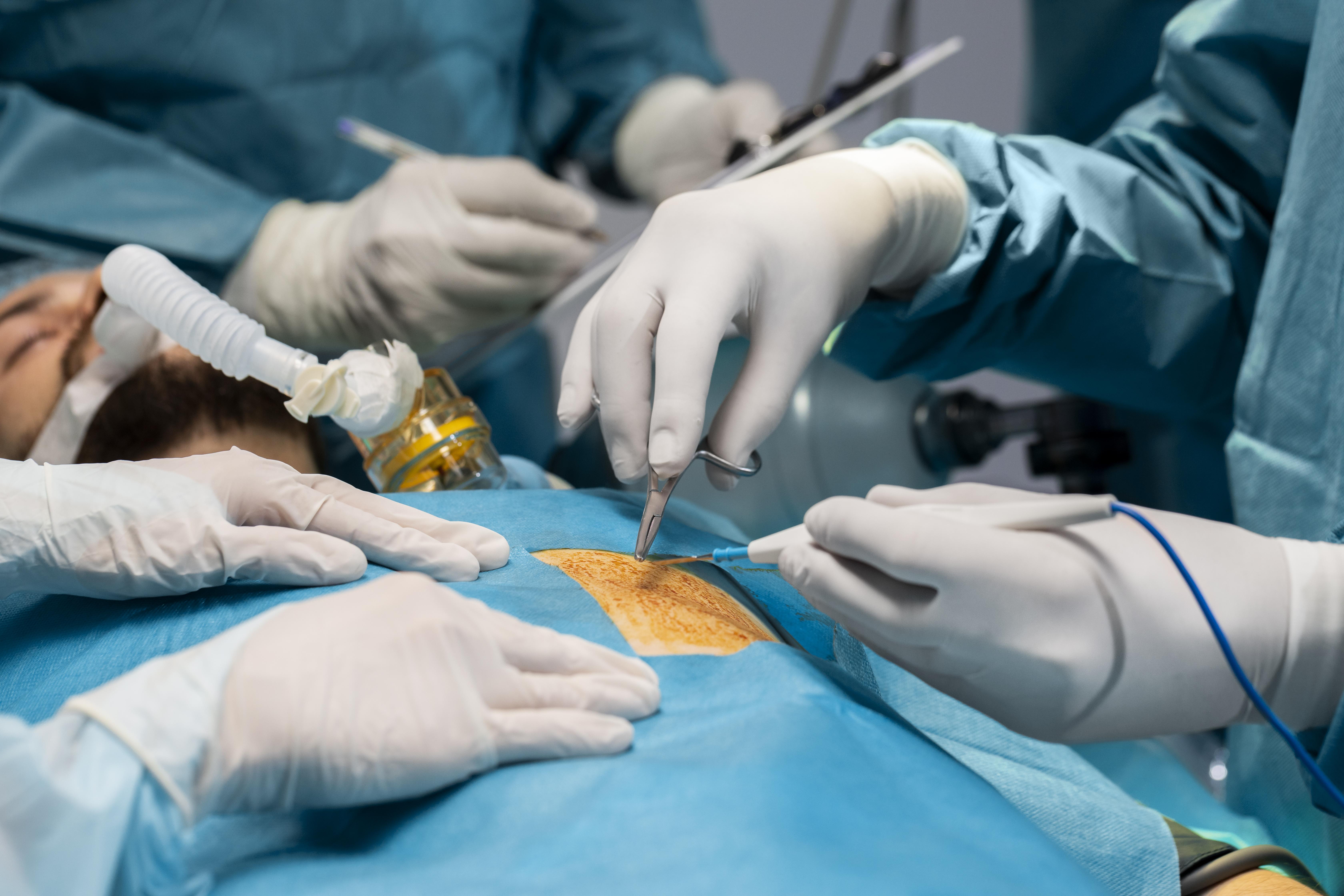 Best Arthroscopy Rotator Cuff Repair Surgeon in Delhi – Dr. Shekhar Srivastav