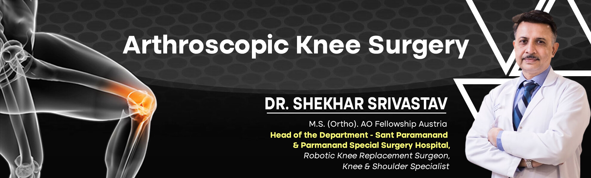 Arthroscopy Surgery